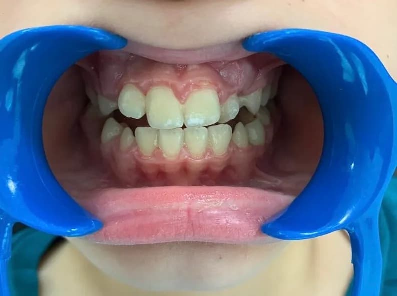 Ortodonti Uzmanı Dr. Rıdvan CEYLAN - İzmit Ortodonti - Gebze Ortodonti - İzmit Diş Teli - Gebze Diş Teli klinik kapak fotoğrafı
